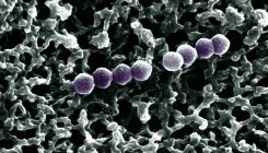 [:es]Un antibiótico utilizado en la Unión Soviética es la nueva esperanza contra las superbacterias[:]
