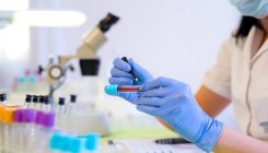 [:es]Autismoarekin lotutako 200 generi eragiten dien proteina bat aurkitu dute[:]