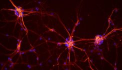 [:es]Un estudio demuestra cómo el ejercicio favorece la formación de nuevas neuronas[:]