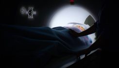 [:es]Así ha pasado la inteligencia artificial de diagnosticar el cáncer a tratarlo[:]