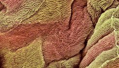 [:es]Researchers Explore a Cancer Paradox[:]