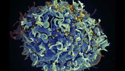 [:es]Virus detectives test whole-body scans in search of HIV’s hiding places[:]