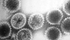[:es]Gero eta ikerketa gehiagok erakusten du herpes birusa alzheimerraren arrisku-faktorea dela[:]
