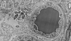 [:es]Do gut bacteria make a second home in our brains?[:]