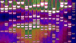 [:es]Machine learning spots natural selection at work in human genome[:]