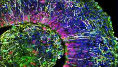 [:es]Lab-grown ‘mini brains’ produce electrical patterns that resemble those of premature babies[:]