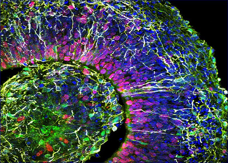 [:es]Lab-grown ‘mini brains’ produce electrical patterns that resemble those of premature babies[:]