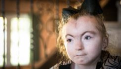 [:es]AI face-scanning app spots signs of rare genetic disorders[:]