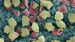 [:es]Descubren el reloj biológico de infartos e infecciones[:]