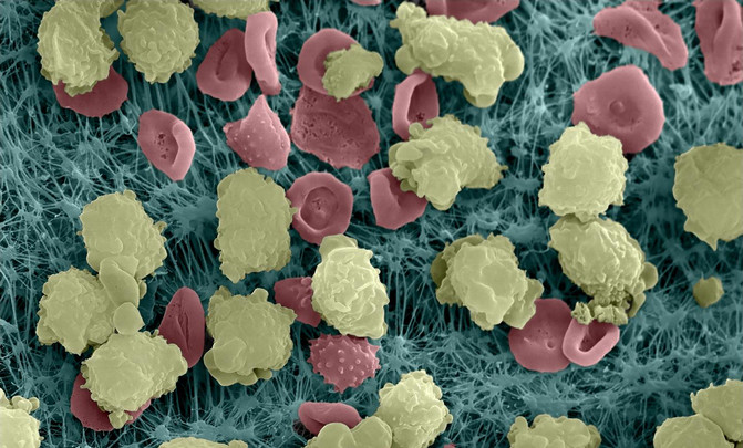 [:es]Descubren el reloj biológico de infartos e infecciones[:]