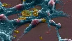 [:es]Una prueba basada en metilación detecta la presencia de cáncer en un análisis de 10 minutos[:]