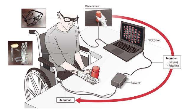 [:es]Llegan las prótesis robóticas que predicen tus intenciones [:]