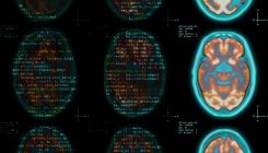 [:es]Cerebro: ni usas el 10%, ni todo lo ‘neuro-algo’ es el futuro [:]
