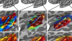 [:es]Las personas con oído absoluto tienen un cerebro especial [:]