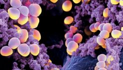 [:es]Dos nuevos antibióticos para hacer frente a bacterias multirresistentes[:]