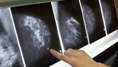 [:es]Las enigmáticas curaciones del cáncer[:]
