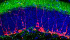 [:es]Demuestran que los beneficios cognitivos del ejercicio físico se heredan[:]