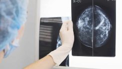 [:es]Una IA pronostica cáncer de mama sin sesgos de raza[:]