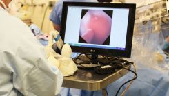 [:es]Un robot penetra en el corazón de un cerdo vivo igual que los cirujanos[:]
