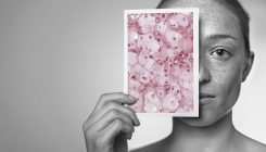 [:es]The human body is a mosaic of different genomes[:]