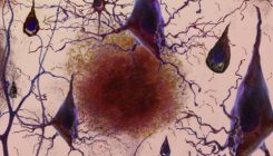 [:es]Identifican un mecanismo desconocido hasta ahora en la patogénesis de la enfermedad de Alzheimer[:]