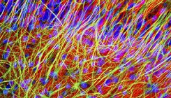 [:es]Hallucinations implanted in mouse brains using light[:]