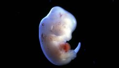 [:es]Japan approves first human-animal embryo experiments[:]