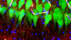 [:es]Cellular Life, Death and Everything in Between[:]