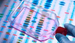 [:es]Geneticists retract study suggesting first CRISPR babies might die early[:]