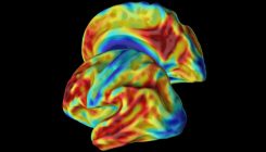 [:es]Colombian woman’s genes offer new clues to staving off Alzheimer’s[:]