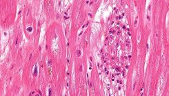[:es]Zelula amek ez, haiek eragiten duten erantzun immunologikoak hobetzen ditu bihotzak[:]