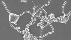 [:es]Hallado el organismo que explica el origen de toda la vida compleja en la Tierra[:]