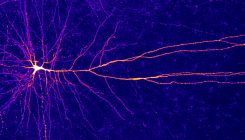 [:es]Hidden Computational Power Found in the Arms of Neurons[:]