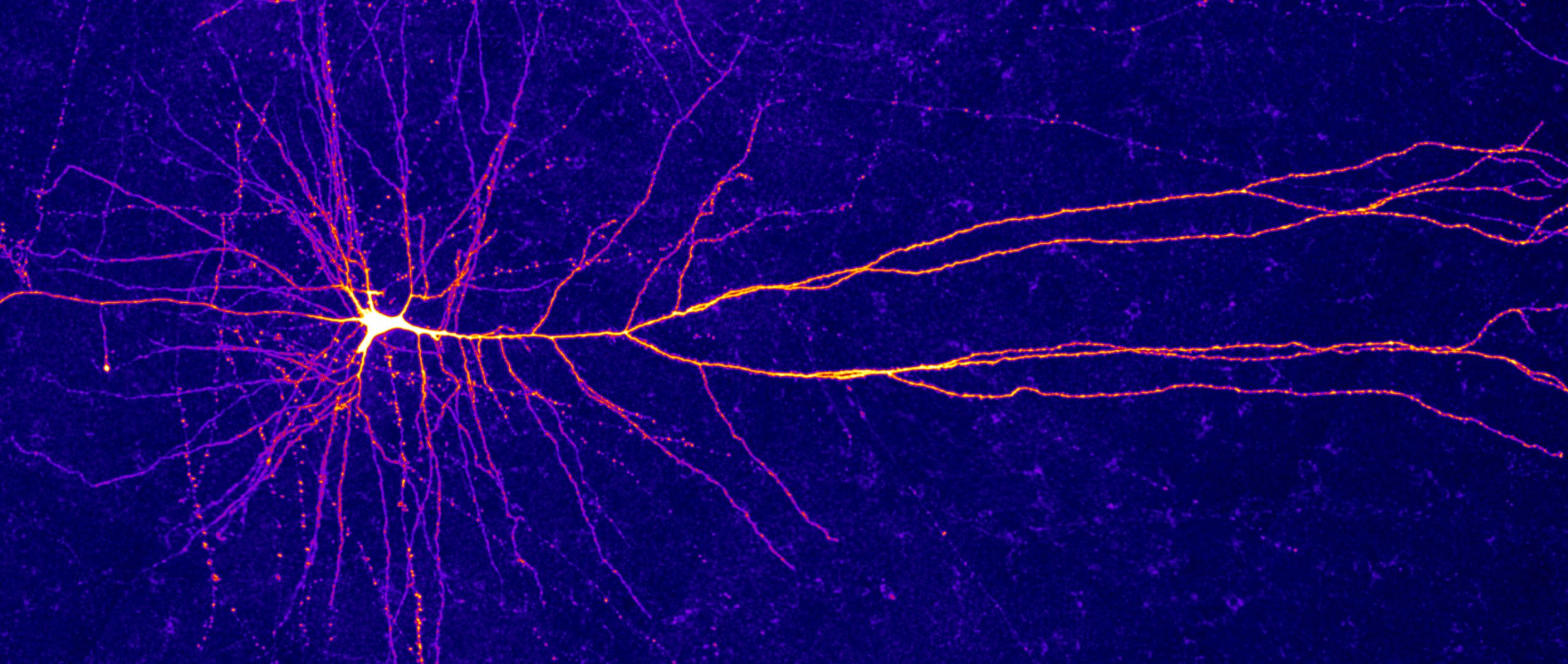 [:es]Hidden Computational Power Found in the Arms of Neurons[:]