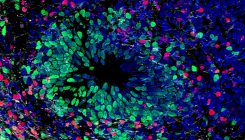 [:es]An Ethical Future for Brain Organoids Takes Shape[:]