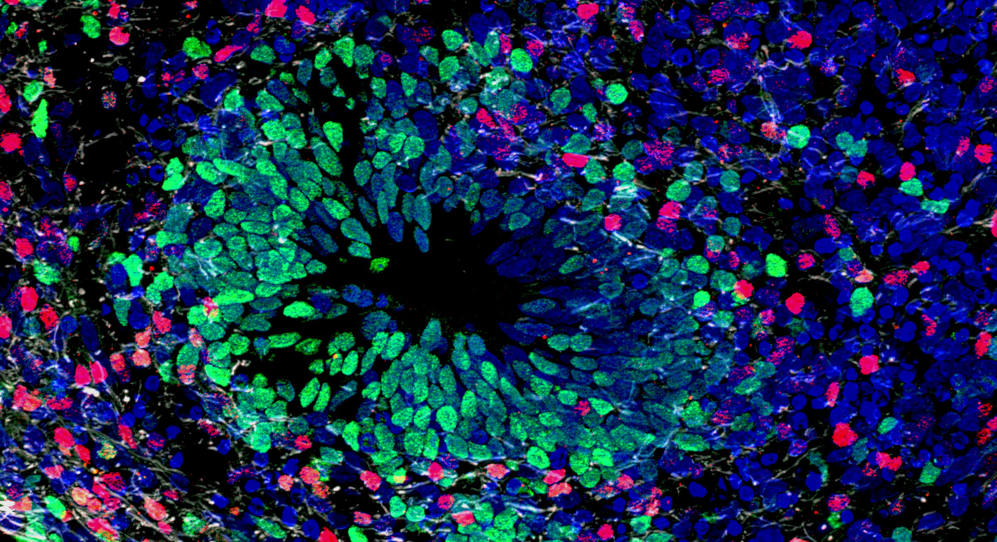 [:es]An Ethical Future for Brain Organoids Takes Shape[:]