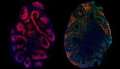 [:es] Un momento: los ‘minicerebros’ de laboratorio no crecen como los de verdad [:]