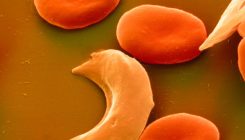 [:es]Quest to use CRISPR against disease gains ground[:]