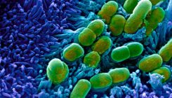 [:es]Powerful antibiotics discovered using AI[:]