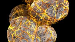 [:es]Descubren un nuevo tipo de célula en el cuerpo de la mujer[:]