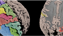 [:es]Publicado el primer mapa genético de la corteza cerebral[:]