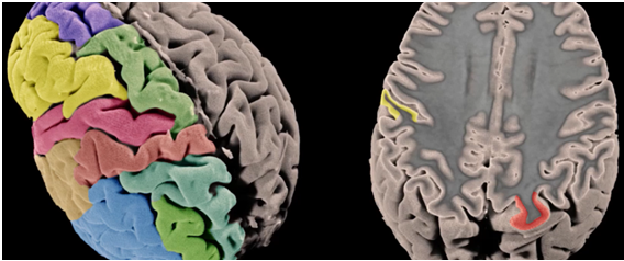 [:es]Publicado el primer mapa genético de la corteza cerebral[:]