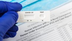 [:es] Los test masivos deben estar dirigidos a las personas de riesgo, no a toda la población[:]