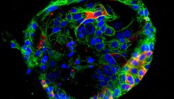 [:es]Mini organs reveal how the coronavirus ravages the body[:]