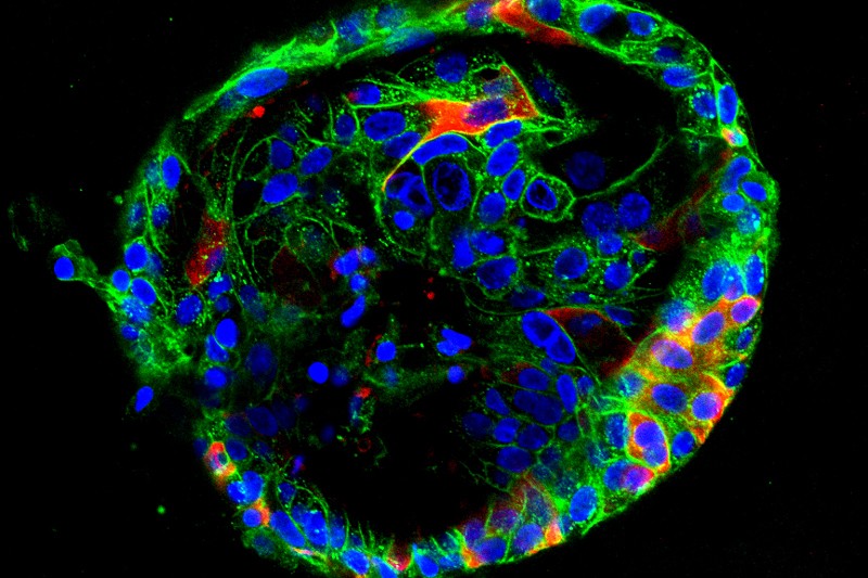 [:es]Mini organs reveal how the coronavirus ravages the body[:]