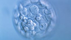 [:es]CRISPR gene editing in human embryos wreaks chromosomal mayhem[:]