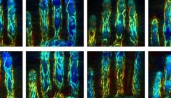 [:es]I’d know those finger veins anywhere[:]