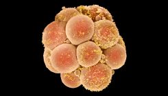 [:es]‘CRISPR babies’ are still too risky, says influential panel[:]