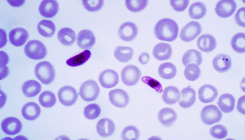 [:es] El parásito de la malaria sortea la estación seca “escondido” en la sangre humana [:]