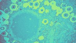 [:es]Did Viruses Create the Nucleus? The Answer May Be Near.[:]